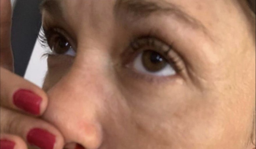 Silvina Di Raimondo se operó con Aníbal Lotocki, el médico condenado por "lesiones graves", luego de que empeoró su salud