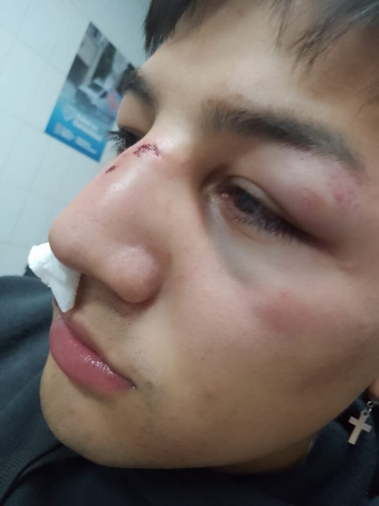 Violento ataque en patota a una joven pareja en la peatonal de Lomas de Zamora: “Nos pateaban la cabeza entre varios”