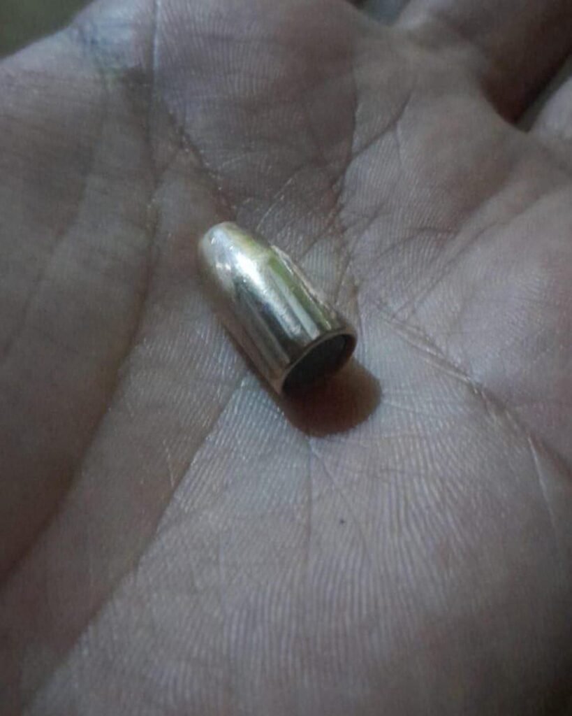 Una bala perdida de un "velorio tumbero" cayó en su casa y rozó la pierna de su hijo de 13 años: "Hoy podríamos estar velando a mi hijo”