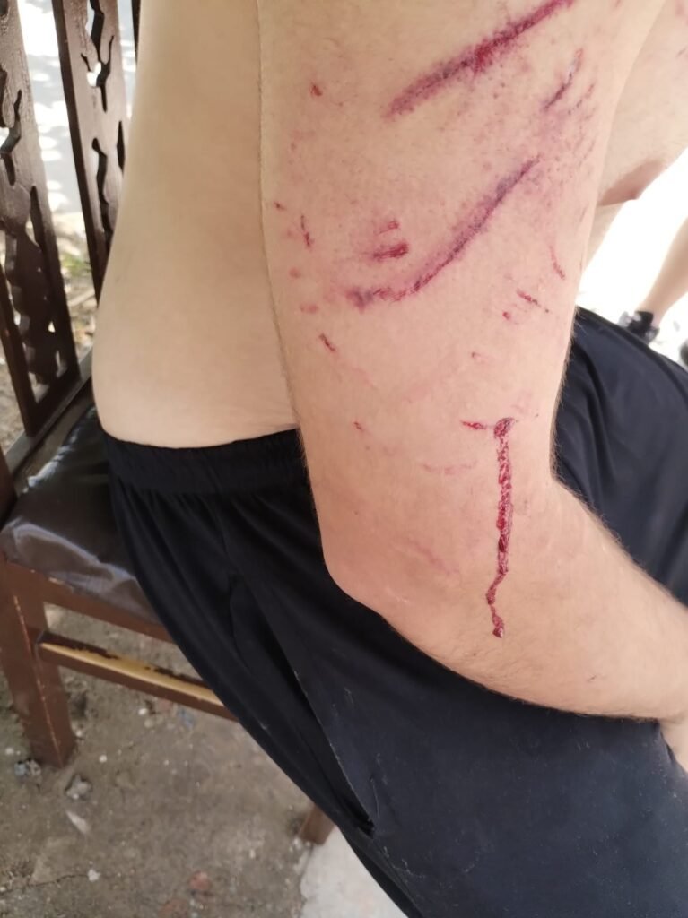 Vecinos reclaman la intervención de Zoonosis por perros peligrosos y denuncian irresponsabilidad de sus dueños
