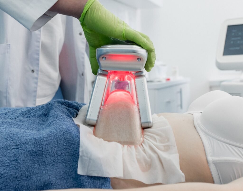 Una vecina denuncia quemaduras tras realizarse una criolipólisis, un tratamiento estético en una estética del barrio