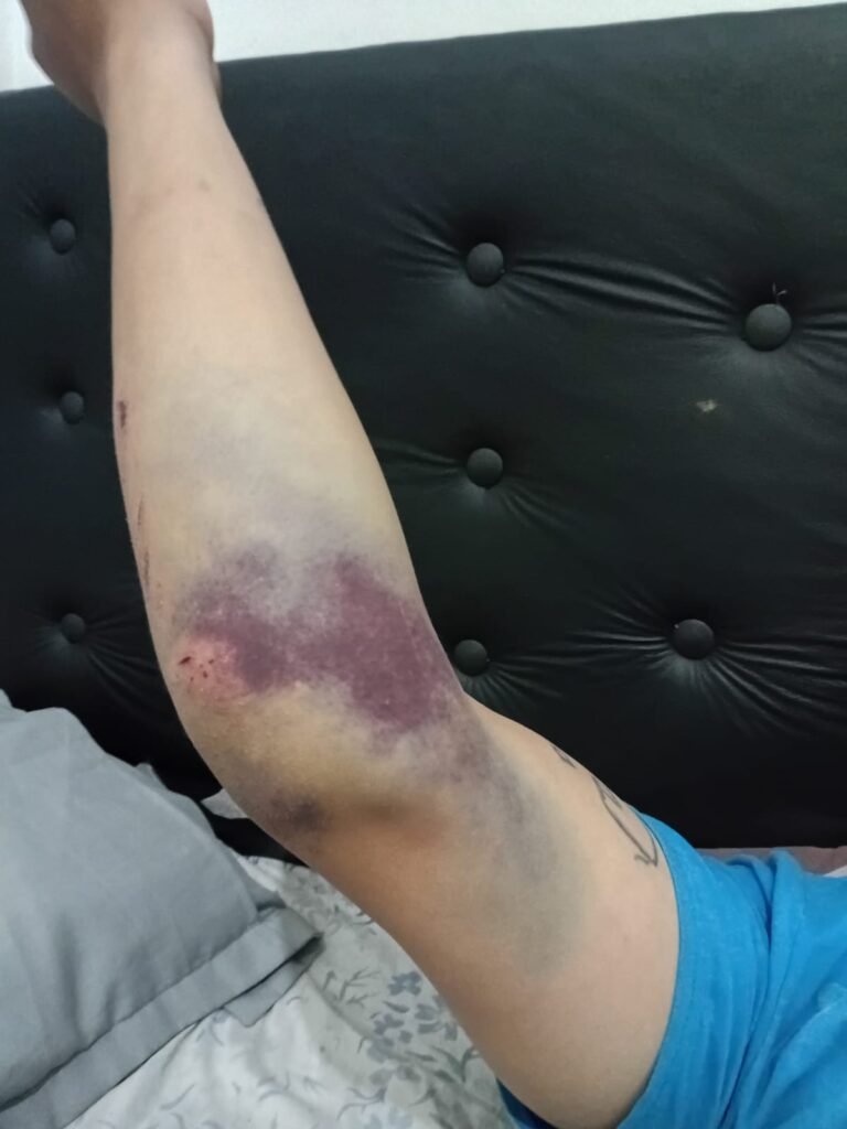 Buscan a un conductor de una camioneta que atropelló y abandonó a un repartidor en el UPA de Fiorito